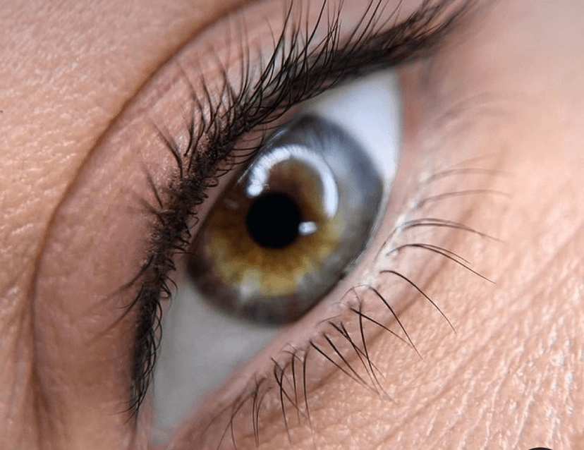 Межресничка